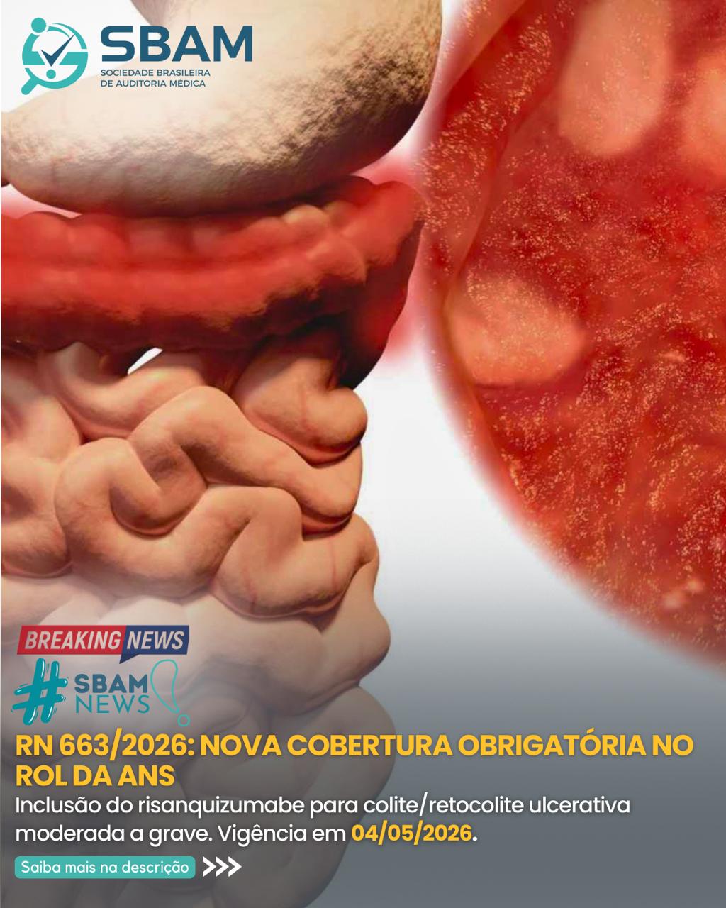 RN 663/2026 | Atualização no Rol da ANS
